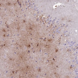 MTSS1L Antibody, Novus Biologicals 25 &mu;L, Unlabeled:Antibodies, Polyclonal